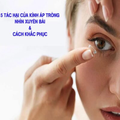 5 Tác Hại Của Kính Áp Tròng Nhìn Xuyên Bài Và Cách Khắc Phục